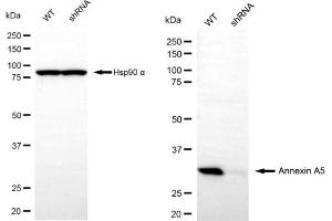 Western blotting analysis using annexin A5 antibody (ABIN7797621).