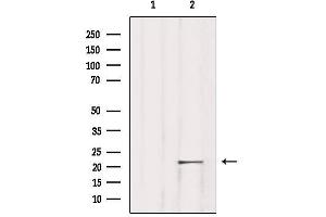 Western blot analysis of extracts from Rat lung, using TNFAIP8L1 Antibody. (TNFAIP8L1 anticorps  (Internal Region))