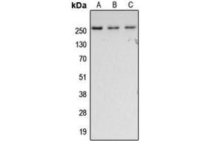 Western blot analysis of Fibronectin expression in HeLa (A), SP2/0 (B), rat lung (C) whole cell lysates. (Fibronectin anticorps  (C-Term))