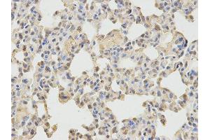 Immunohistochemistry (IHC) image for anti-Neural Wiskott-Aldrich syndrome protein (WASL) antibody (ABIN1875345) (Neural Wiskott-Aldrich syndrome protein (WASL) anticorps)
