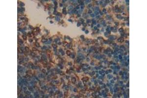 Used in DAB staining on fromalin fixed paraffin- embedded Kidney tissue (LAG3 anticorps  (AA 209-451))