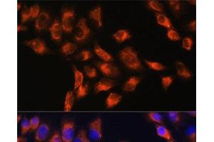 Immunofluorescence analysis of HeLa cells using C1 Inactivator Polyclonal Antibody at dilution of 1:100. (SERPING1 anticorps)