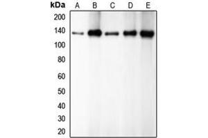 Western blot analysis of E Cadherin expression in HEK293T (A), PC12 (B), A431 (C), MCF7 (D), C2C12 (E) whole cell lysates.