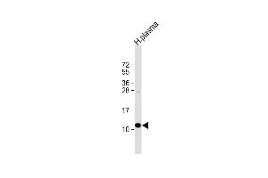 Anti-OA2 Antibody (Center) at 1:1000 dilution + human plasma lysate Lysates/proteins at 20 μg per lane. (APOA2 anticorps  (AA 28-56))