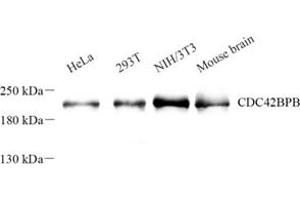 Western blot analysis of Cdc42bpb (ABIN7073411) at dilution of 1: 500 (CDC42BPB anticorps)