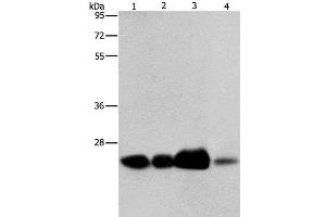 Western Blot analysis of 293T cell and Human fetal liver tissue, Human cervical cancer and fetal muscle tissue using ARFRP1 Polyclonal Antibody at dilution of 1:800 (ARFRP1 anticorps)