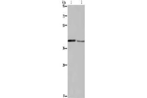 Gel: 8 % SDS-PAGE, Lysate: 40 μg, Lane 1-2: Mouse small intestine tissue, Mouse skin tissue, Primary antibody: ABIN7129190(DEGS1 Antibody) at dilution 1/450, Secondary antibody: Goat anti rabbit IgG at 1/8000 dilution, Exposure time: 5 minutes