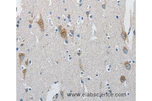 Immunohistochemistry of Human brain  using ATG4A Polyclonal Antibody at dilution of 1:30 (ATG4A anticorps)