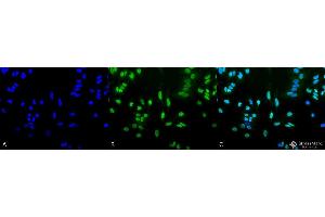 Immunocytochemistry/Immunofluorescence analysis using Rabbit Anti-Acetylated Lysine Polyclonal Antibody . (Lysine (lys) (acetylated) anticorps (Biotin))