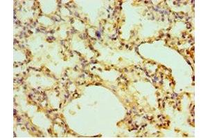 Immunohistochemistry of paraffin-embedded human lung tissue using ABIN7151442 at dilution of 1:100 (EGLN1 anticorps  (AA 301-426))