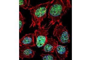 Immunofluorescence (IF) image for anti-Forkhead Box O6 (Foxo6) antibody (ABIN2996675)