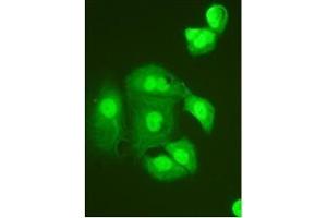 Immunocytochemistry on HeLa Cell (TNFAIP1 anticorps  (N-Term))