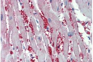 Human Heart: Formalin-Fixed, Paraffin-Embedded (FFPE) (alpha 1 Adrenergic Receptor anticorps  (AA 206-270))