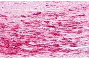 Image no. 1 for anti-Bradykinin Receptor B1 (BDKRB1) (Cytoplasmic Domain) antibody (ABIN1048348)