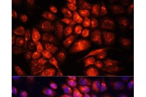 Immunofluorescence analysis of HeLa cells using UCP3 Polyclonal Antibody at dilution of 1:100. (UCP3 anticorps)