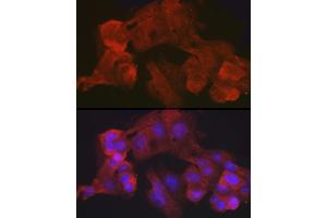 Immunofluorescence analysis of HepG2 cells using Villin1 Rabbit mAb (ABIN7271323) at dilution of 1:100 (40x lens). (Villin 1 anticorps)