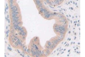 DAB staining on IHC-P; Samples: Mouse Uterus Tissue (GDF5 anticorps  (AA 358-495))