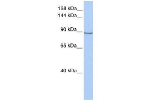 Hexokinase 2 antibody used at 1 ug/ml to detect target protein. (Hexokinase 2 anticorps  (N-Term))