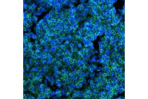 IF analysis of CD45 using anti-CD45 antibody (ABIN7602776).