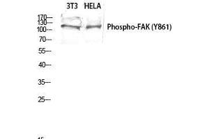 Western Blot (WB) analysis of 3T3 HeLa lysis using Phospho-FAK (Y861) antibody.