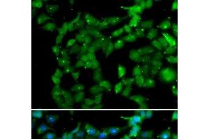 Immunofluorescence analysis of U2OS cells using PRKAB2 Polyclonal Antibody