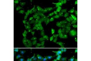 Immunofluorescence analysis of U2OS cells using PRKAB2 Polyclonal Antibody (PRKAB2 anticorps)