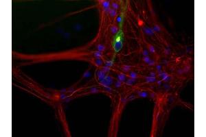 Mixed neuron/glia cultures from newborn rat brain stained with ABIN1580456 antibody to peripherin (green) and rabbit polyclonal antibody to NF-L RPCA-NF-L (red channel). (Peripherin anticorps)