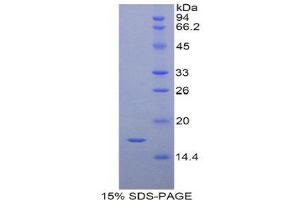 SDS-PAGE (SDS) image for Retinol Binding Protein 7, Cellular (RBP7) (AA 1-134) protein (His tag) (ABIN1821782) (RBP7 Protein (AA 1-134) (His tag))
