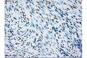 Image no. 13 for anti-B-Raf proto-oncogene, serine/threonine kinase (BRAF) antibody (ABIN1496961)