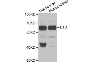 Western Blotting (WB) image for anti-Biotinidase (BTD) antibody (ABIN1980300)