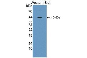 Western blot analysis of the recombinant protein. (TNNT1 anticorps  (AA 1-261))