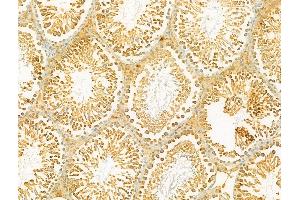 ABIN6264964 and ABIN6273072 at 1/100 staining Rat testis tissue by IHC-P. (SECISBP2 anticorps  (Internal Region))