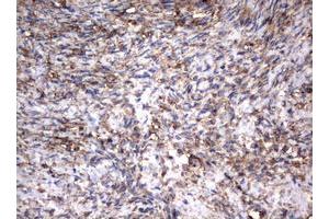 Image no. 13 for anti-Vimentin (VIM) (AA 210-466) antibody (ABIN1491200)