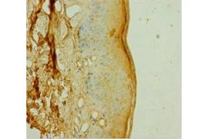 Immunohistochemistry of paraffin-embedded human skin tissue using ABIN7150562 at dilution of 1:100