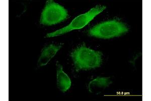 Immunofluorescence of monoclonal antibody to CDK4 on HeLa cell. (CDK4 anticorps  (AA 211-303))