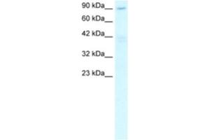 Western Blotting (WB) image for anti-Chromosome 20 Open Reading Frame 194 (C20orf194) antibody (ABIN2460292) (C20orf194 anticorps)