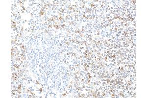 Immunohistochemistry (IHC) image for anti-Interleukin 7 Receptor (IL7R) (AA 21-236) antibody (ABIN7453897) (Recombinant IL7R anticorps  (AA 21-236))