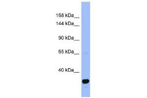 FANCA antibody used at 1 ug/ml to detect target protein. (FANCA anticorps  (N-Term))