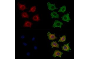 ABIN6256799 and ABIN6267420 staining HepG2 cells(4h of LPS treatment) by IF/ICC. (Phospholipase C gamma 1 anticorps  (pTyr771))