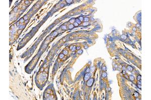 ABIN6258512 and ABIN6274729 at 1/100 staining Rat stomach tissue by IHC-P. (MRPL13 anticorps  (C-Term))