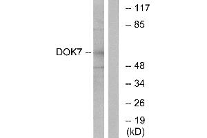 Immunohistochemistry analysis of paraffin-embedded human brain tissue using DOK7 antibody. (DOK7 anticorps  (N-Term))