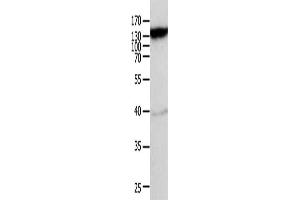 Gel: 10 % SDS-PAGE, Lysate: 40 μg, Lane: Mouse heart tissue, Primary antibody: ABIN7189591(ABCC5 Antibody) at dilution 1/950, Secondary antibody: Goat anti rabbit IgG at 1/8000 dilution, Exposure time: 10 minutes (ABCC5 anticorps)