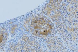 ABIN6268949 at 1/100 staining Human uterus tissue by IHC-P. (CXCL1 anticorps  (Internal Region))
