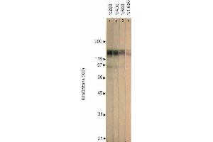 Western Blotting (WB) image for anti-Herpes Simplex Virus Type 1 ICP4 (HSV1 ICP4) antibody (ABIN265556) (HSV1 ICP4 anticorps)