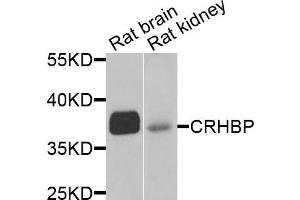 Western blot analysis of extracts of rat brain and rat kidney cells, using CRHBP antibody. (CRHBP anticorps)