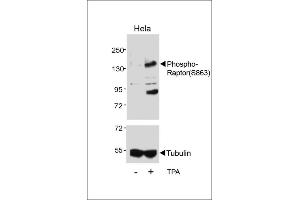 Western blot analysis of lysates from Hela cell line, untreated or treated with T, 200nM , using Phospho-Raptor Antibody (upper) or tubulin (lower). (RAPTOR anticorps  (pSer863))