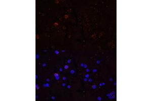 Immunofluorescence analysis of THP-1 cells using CD86 Polyclonal Antibody (ABIN7266226) at dilution of 1:100 (40x lens). (CD86 anticorps)