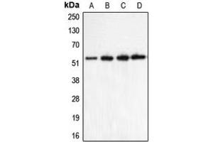 Western blot analysis of CHRNA5 expression in HeLa (A), Jurkat (B), mouse brain (C), rat brain (D) whole cell lysates.