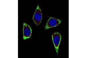 Confocal immunofluorescent analysis of RET Antibody (Ascites) ABIN659065 with MDA-M cell followed by Alexa Fluor® 488-conjugated goat anti-mouse lgG (green). (Ret Proto-Oncogene anticorps)
