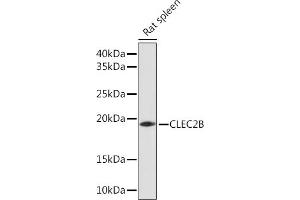 Western blot analysis of extracts of Rat spleen, using CLEC2B Rabbit pAb (ABIN7265981) at 1:1000 dilution.
